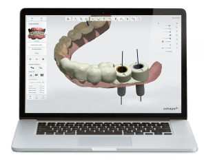 3d digital impressions
